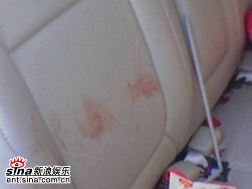 独家组图:何洁车祸现场惨不忍睹座椅血迹斑斑