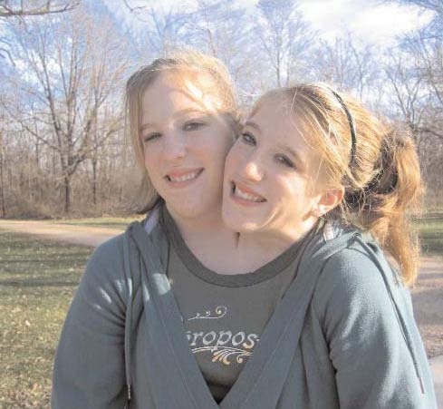 美国18岁<em>连体姐妹</em>渴望<em>结婚</em>生子(组图)-<em>姐妹</em>,结