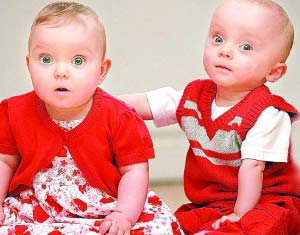 英国大小双胞胎存活 出生时体重差1倍(图)-大