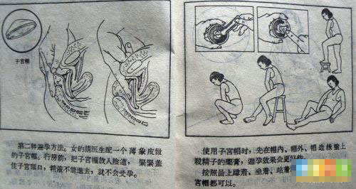 52年前夫妻这样避孕-避孕方式,药膏,注入器,避
