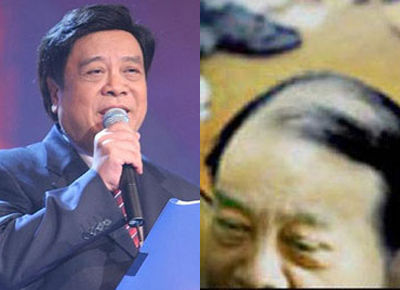 男星秃顶连环爆 刘德华李亚鹏陷落<em>发</em>危机(图)-