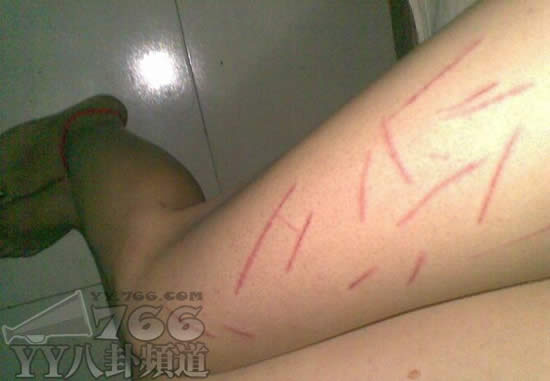 90<em>自残女</em>引发评论+我们应该给予宽容
