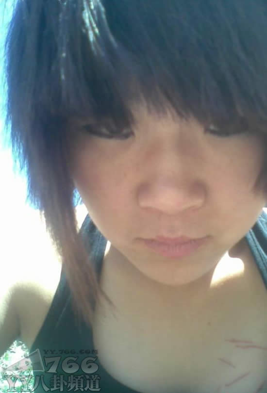 90<em>自残女</em>引发评论+我们应该给予宽容