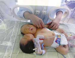 丢失发票想去医保报销 来回跑断腿仍一无所获