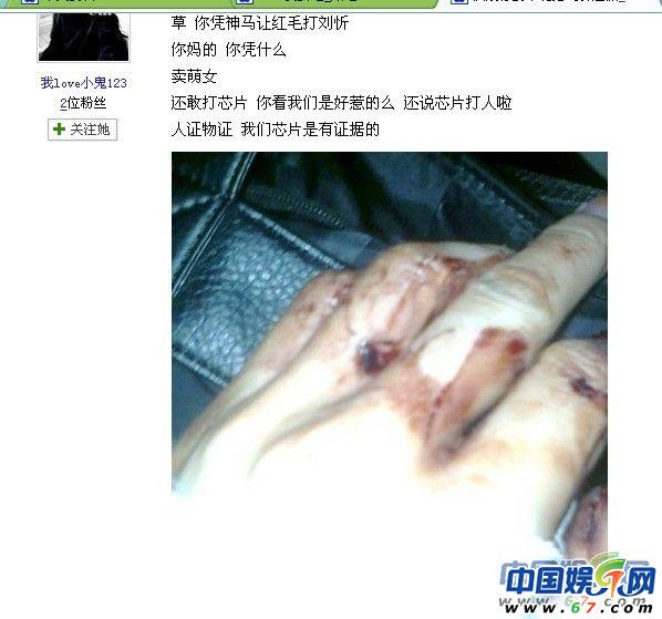 洪辰及父母被打内幕 刘忻洪辰粉丝冲突现场图