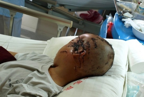 慎入!<em>8岁男孩</em>遭恶母乱砍 缝800针(组图)-血肉模