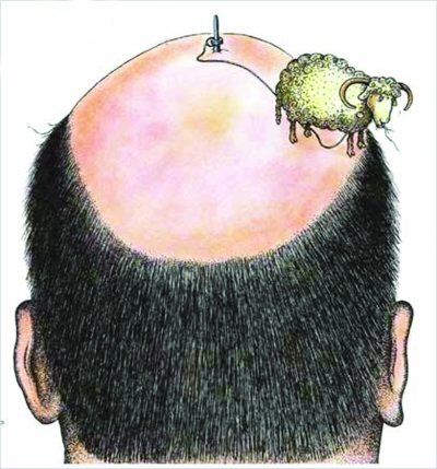 90后吃肉熬夜致脱发提前20年-预防脱发,90后