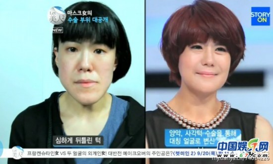 韩国整容节目丑女变美 网友:屌丝重生-韩国整容