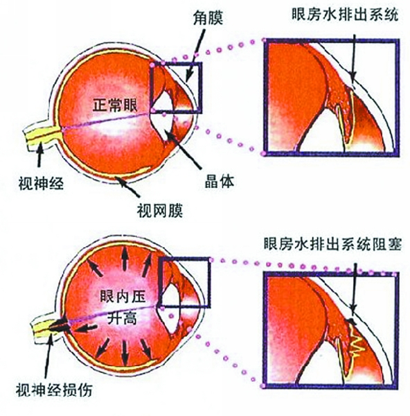 关灯玩手机易患青光眼吗?--中国宁波网-新闻中心