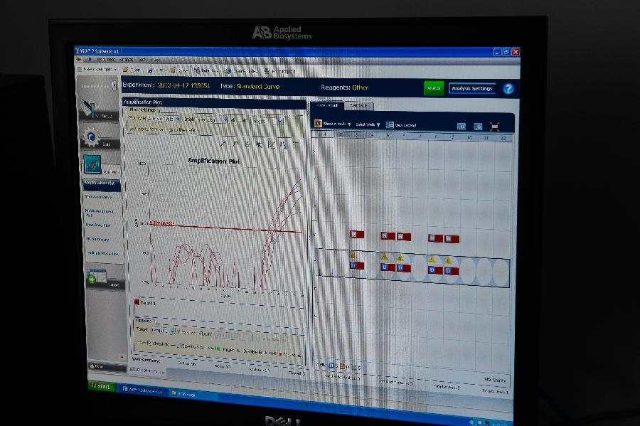 ���»�ֱ������5��Ŀ���㽭ʡ��������H7N9����������