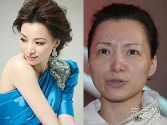 皮肤很差的女星