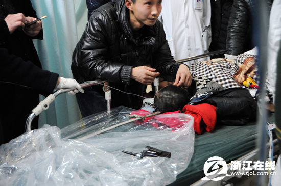 1米多长钢筋插入嘉兴6岁男童头部 正转到上海