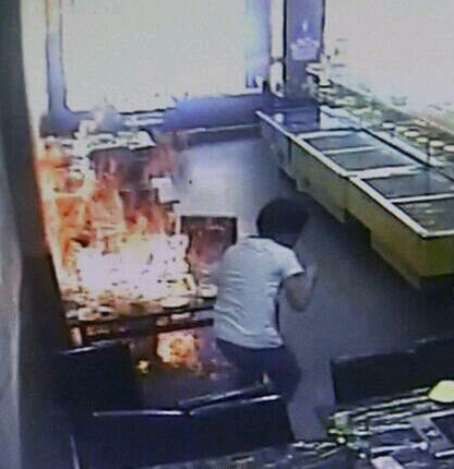 义乌烧伤女孩赔偿难 律师解读饭店吃饭出意外