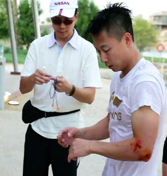 极速明星李小鹏见血,月亮膑骨错位-明星,李小鹏