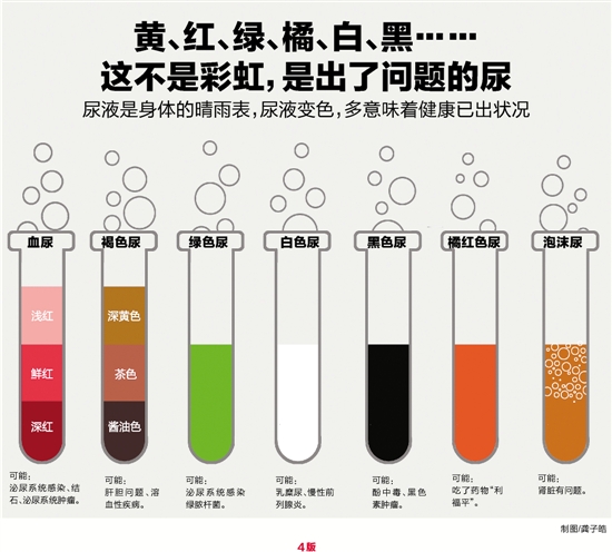 尿尿的颜色有什么讲究?