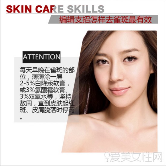 夏季雀斑成困扰 编辑支招去斑-夏季,雀斑,一定