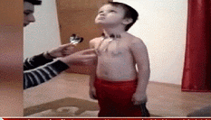 5岁男童成小“万磁王” 身体能吸铁器