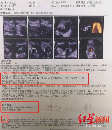 (达州市中心医院的四维彩超报告)