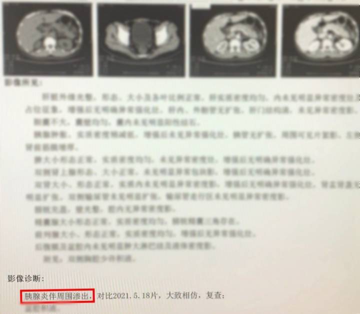 ct检查报告.jpg