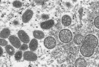 美国宣布因猴痘疫情进入公共卫生紧急状态