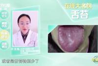 身体好不好看舌苔就知道！出现这3种颜色要注意