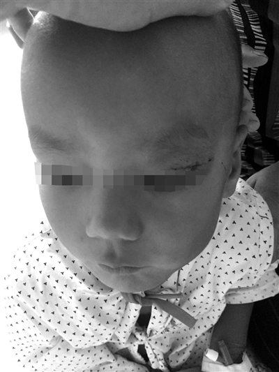 宁波80后眼科医生援疆一周就做了一个"大手术"